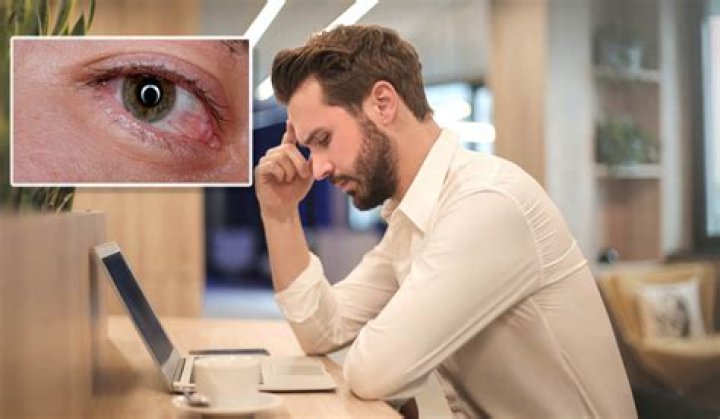 How can I stop my eyes from hurting when working on the computer?